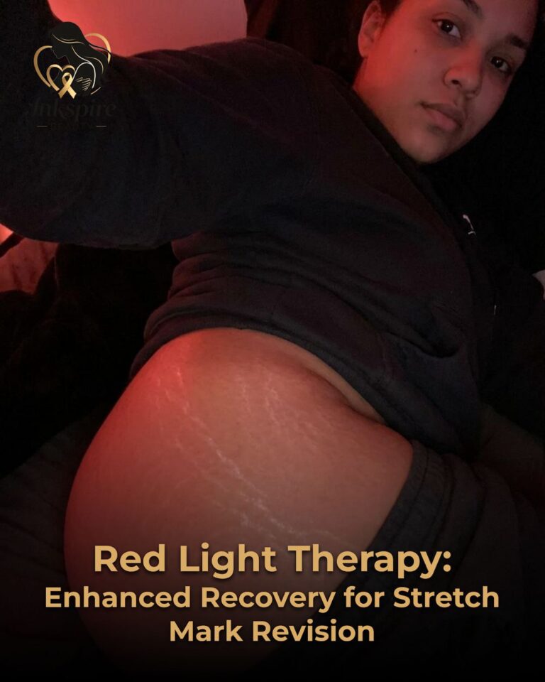 Red Light Therapy: Enhanced Recovery for Stretch Mark Revision